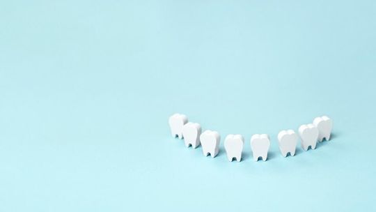 Implanty zębowe: Kompletny przewodnik po procedurze i korzyściach