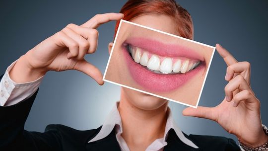 Kiedy warto rozważyć licówki dentystyczne?