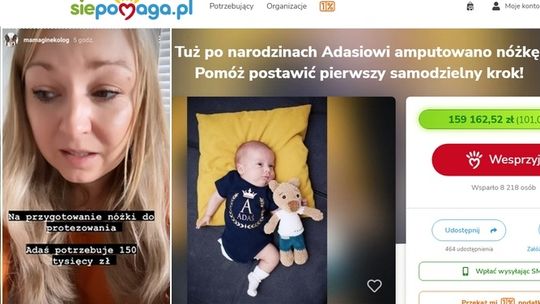 Niesamowity odzew na apel Mamy Ginekolog. Adaś będzie miał protezę!