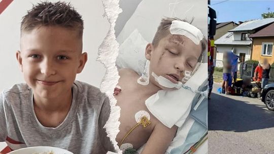 Trwa zbiórka dla Franka potrąconego przez samochód