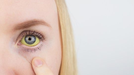 Zdążyć przed żółtym