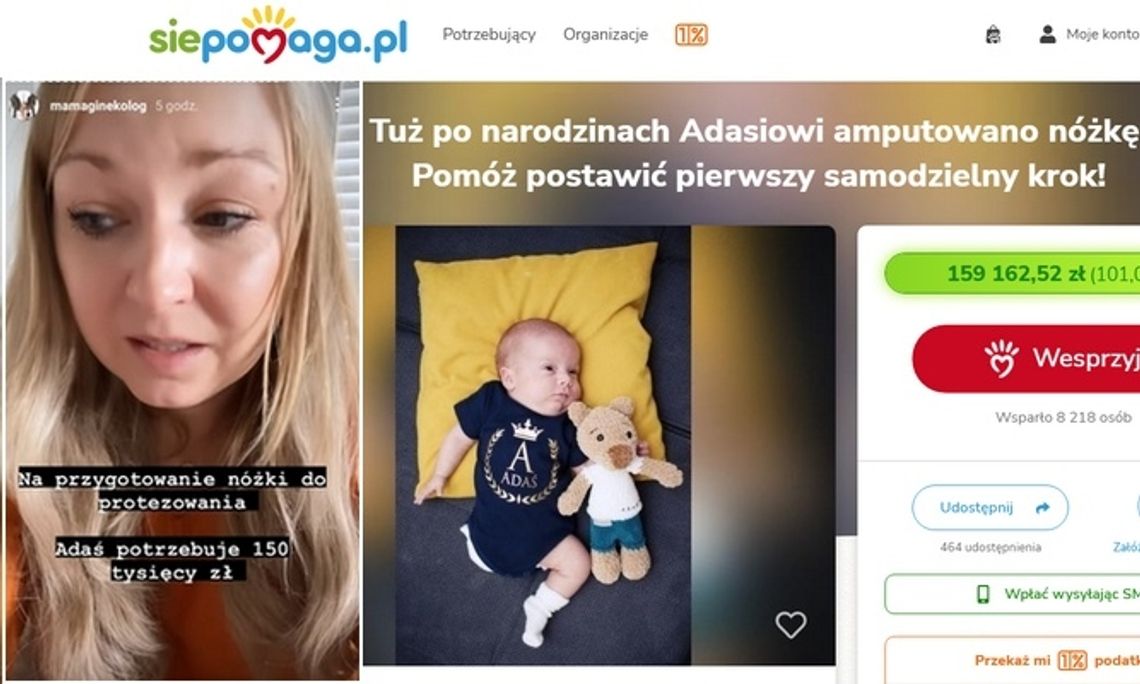 Niesamowity odzew na apel Mamy Ginekolog. Adaś będzie miał protezę!